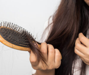hair loss