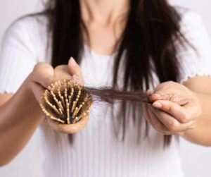 hair loss